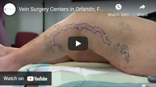 vein surgery